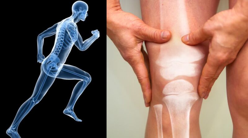 Healthy foods for bone health and calcium deficiency prevention