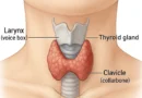 **Alt Text:** Healthy foods recommended for thyroid patients including eggs, fish, yogurt, nuts, seeds, and whole grains arranged on a table with health awareness concept.