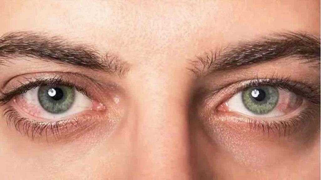 World Sight Day 2026 Eye Health Tips and Blindness Prevention Guide