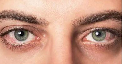 World Sight Day 2026 Eye Health Tips and Blindness Prevention Guide